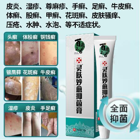 手足牛皮蘚護理止癢乳膏OEM代工